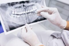 راهنمای جامع سئو برای سایت‌های دندانپزشکی