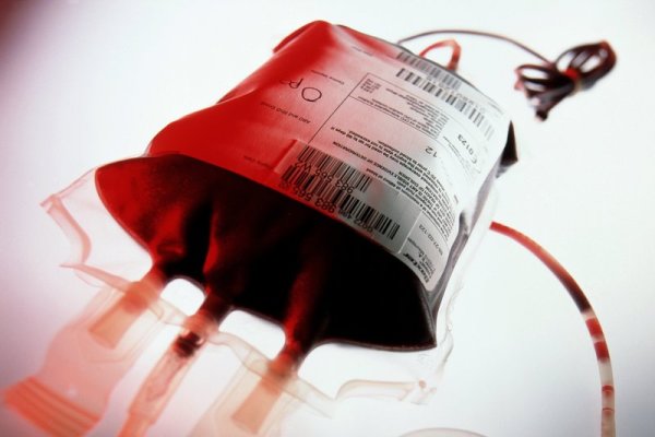 فراورده‌ای با عمر کم و فواید زیاد