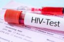 مهم‌ترین چالش امروز HIV در ایران